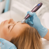 Szkolenie Mezoterapia mikroigłowa (dermapen)
